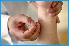 Acupuncture for every one