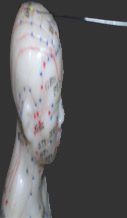 Acupuncture for every one