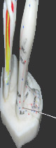 Acupuncture for every one